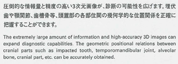 圧倒的な情報量と精度の高い3次元画像が、診断の可能性を広げます。